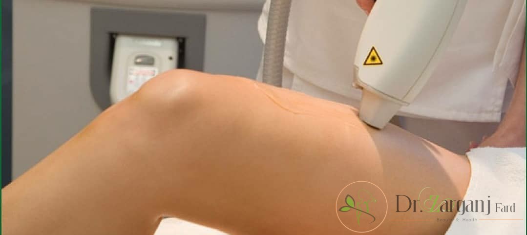 دستگاه IPL