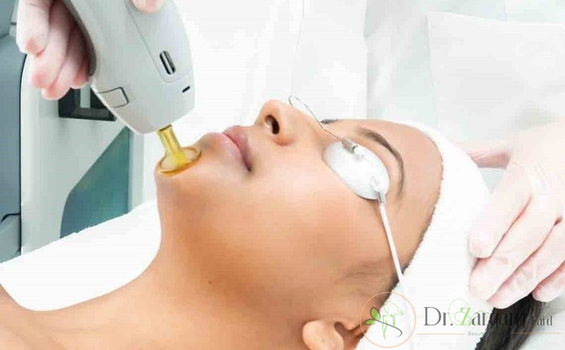 آیا رنگ مو و یا نوع مو تفاوت ایجاد میکند؟