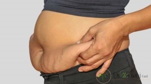 علل ایجاد افتادگی شکم چیست ؟