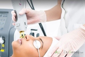 لیزر دایود از چه چیزی تشکیل شده است؟