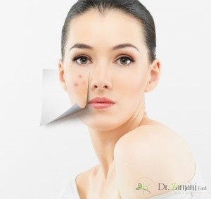 روش های لیزر پوست صورت کدامند؟