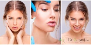 بعد از تزریق چربی چه باید کرد؟