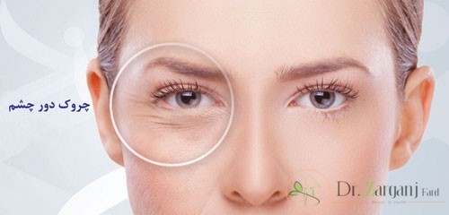 تمدید نکردن تزریق بوتاکس