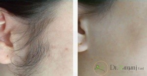 علت پایین بودن هزینه های لیزر در برخی مراکز: