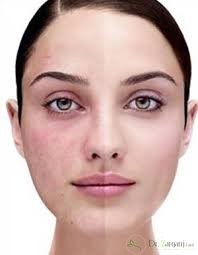 برای حفظ سلامت پوست در مقابل خورشید چه کارهایی باید انجام دهیم؟