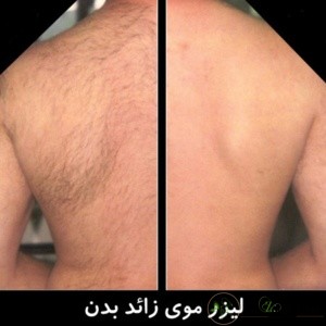 رنگ پوست :