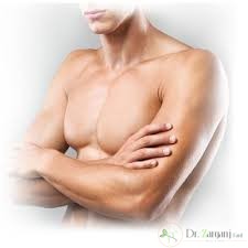 چه کسانی نباید از لیزر مو های زائد استفاده کنند و چرا ؟