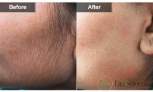 لیست خدماتی مرکز زیبایی لیزر موهای زائد شمال تهران: