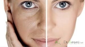 از لیزر در چه مواردی میتوان استفاده کرد؟
