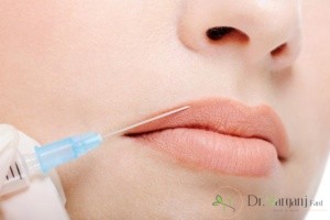 کاربرد ژل های تزریقی صورت را نام ببرید؟