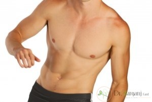 بعد از حذف مو انتظار چه چیزی را داریم؟