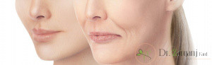 راههای مناسب برای رفع مشکلات به وجود آمده بعد از تزریق ژل چیست؟
