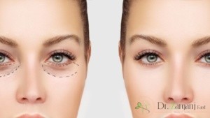 افرادی که نباید از عمل زیبایی بدون بیهوشی یا تامی سنت استفاده کنند؟