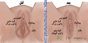 لیزر مونالیزا تاچ
