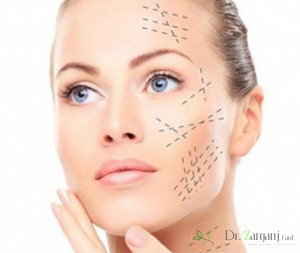 درباره تفاوت تزریق ژل و بوتاکس کدام موارد هستند؟