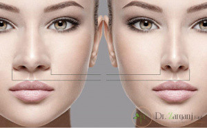 جراحی های زیبایی