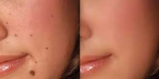 به هیچ عنوان سلامتی تان را فدای کم کردن هزینه نکنید