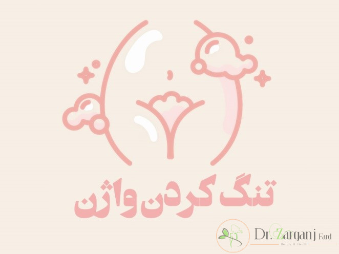 تنگ کردن واژن