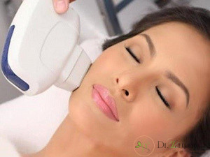 5 مزیت لیزر مو های زائد