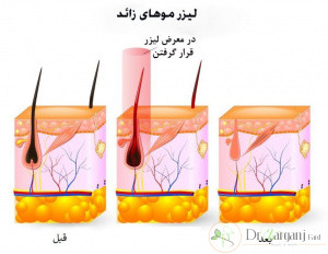 برخی از عوارض