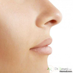 ملاک های اصلی یک جراحی زیبای بینی موفق که تعدادی از آن را این جا ذکر می کنیم