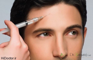 بوتاکس صورت چیست و چگونه انجام میشود؟
