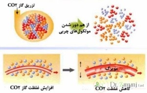 هزینه ی درمان کربوکسی تراپی