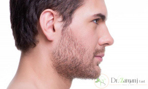 مراقبتهای قبل از انجام بوتاکس صورت آقایان به چه صورت است؟