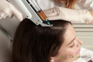 نکاتی که پس از درمان باید به آن توجه کنیم چه نکاتی است؟