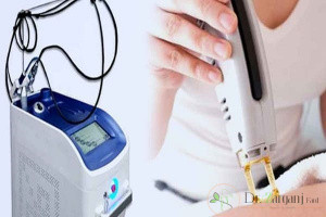 آیا برای لیزر آمادهاید؟