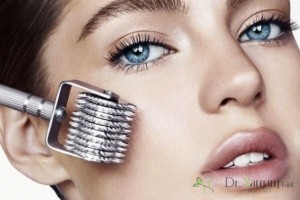 5.میکرونیلدینگ برای جوانسازی پوست