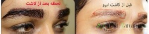 فاکتورهای برای کاشت ابروی طبیعی موفق