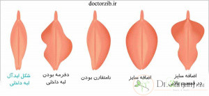 اندازه متوسط واژن در بانوان :