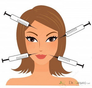 نقاط تزریق بوتاکس