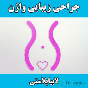 لابیا ماژور
