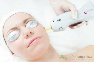 آیا لیزر مو ها موجب ایجاد سرطان میشود ؟