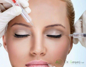 هزینه تزریق بوتاکس چگونه است؟