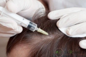 اهداف مزوتراپی چیست؟