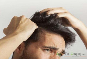 نکات قابل توجه در عمل کاشت مو با موی طبیعی