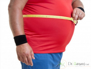 جراحی زیبایی شکم چه تاثیری می تواند بر شکم بیمار داشته باشد؟