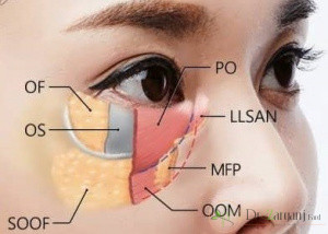 1ـ به چه چیزی فیلرگفته می شود؟