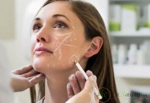 2ـ چه افرادی می توانند برای رفع گودی چشم از تزریق فیلر استفاده کنند؟