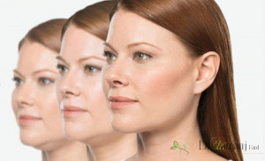 لیفت کردن صورت با استفاده از نخ سیلوئت؟
