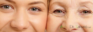 مراقبت های بعد از تزریق ژل