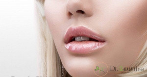 تزریق ژل لب در پزشکی یعنی چه ؟