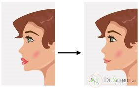 کاربرد های ژل در زیبا سازی صورت؟