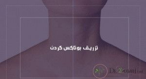 رفع چروک گردن با بوتاکس