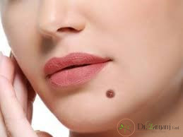 عوارض تزریق ژل ها چگونه است؟