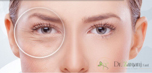 ژل رووفیل اولترا چیست؟