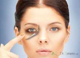 رعایت چه نکاتی بعد از انجام ژل لازم می باشد؟